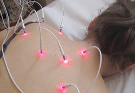 Laser-Akupunktur